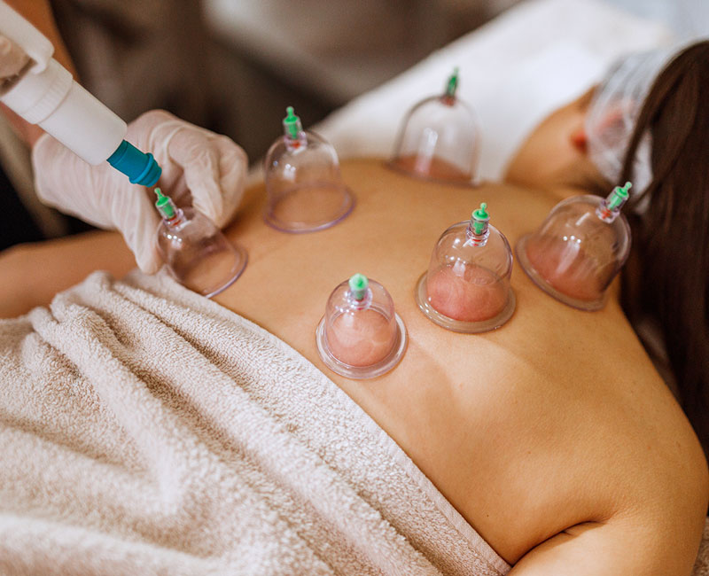 Sports massage with cupping